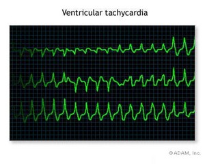 beats graph.jpg